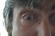 03-09-2011, Oog 18 dagen na de operatie