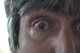 06-09-2011, Oog 3 weken na de operatie