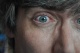 10-09-2011, Oog 25 dagen na de operatie