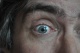 20-09-2011, Oog 5 weken na de operatie