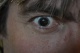 15-02-2012, Na controle bij de oogarts